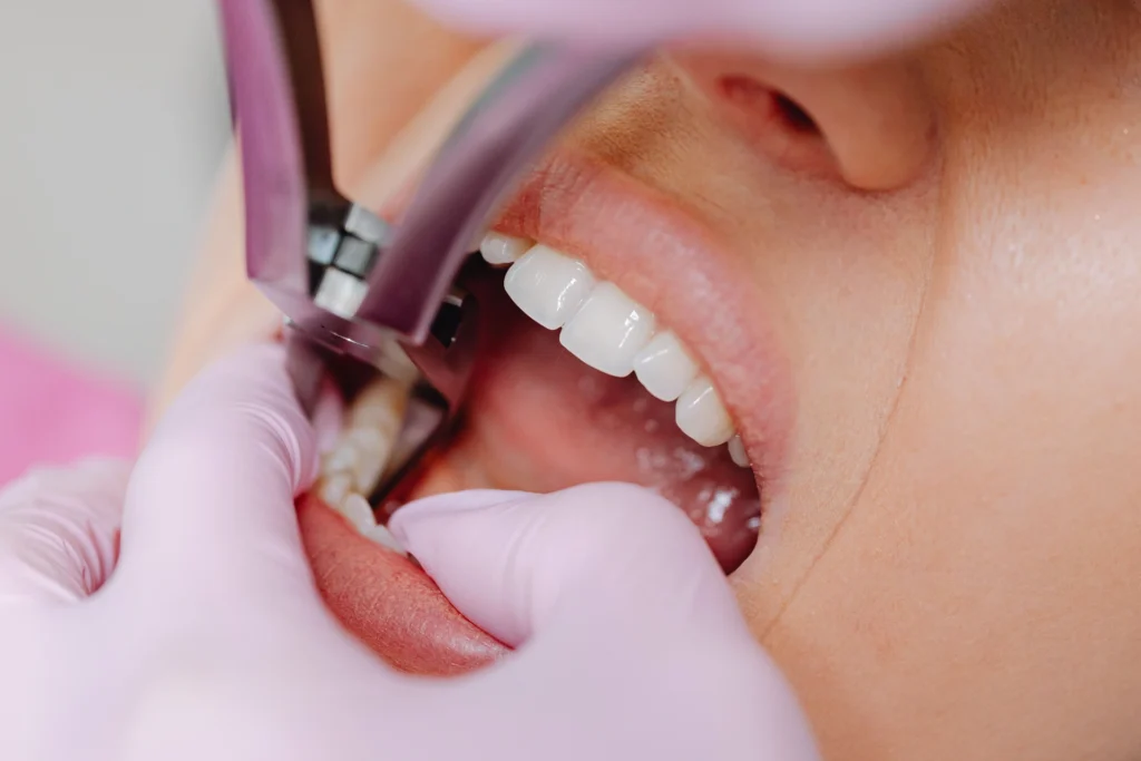 Chirurgia dentale