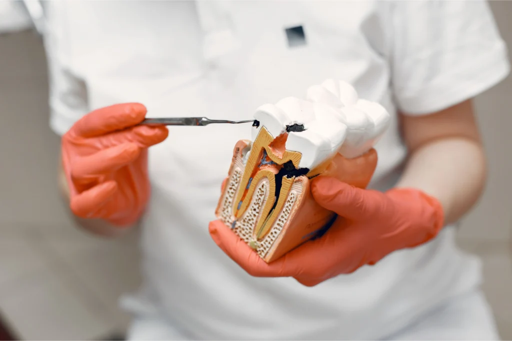 Endodonzia